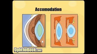 Optometry with Chanaka 11 Refractive Errors Sinhala [upl. by Etiam]