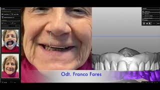 Franco Fares  Dental Tècnic 2024 [upl. by Llezom]