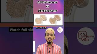 Osteomalacia vs osteoporosis  Difference between osteomalacia amp osteoporosis shorts [upl. by Neirol749]