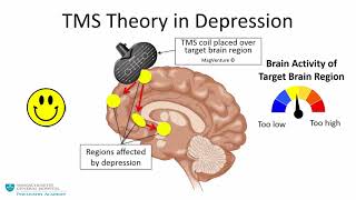 Transcranial Magnetic Stimulation A New Treatment Approach for Psychiatric Disorders [upl. by Ppilihp]