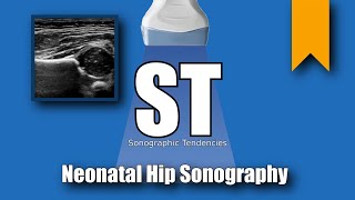 Hip Ultrasound [upl. by Joanne]