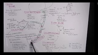 MEJOR EXPLICACIÓN COLELITIASIS COLECISTITIS COLEDOCOLITIASIS COLANGITIS [upl. by Hawthorn]