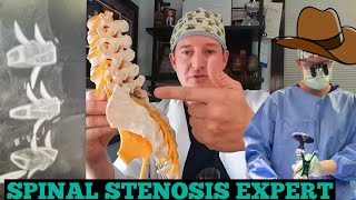 Spinal Stenosis Expert Explains [upl. by Dole]