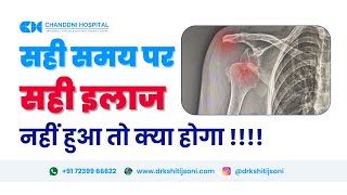 Shoulder dislocation ko nazarandaaj karne ka nuksaan  Patient testimonial [upl. by Brest844]