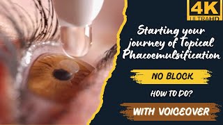 Transitioning to Topical anesthesia in Phacoemulsification surgery with VOICEOVER [upl. by Nnaacissej]