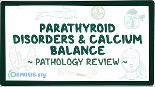 Parathyroid disorders and calcium balance Pathology Review [upl. by Henryetta144]