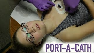 HOW TO ACCESS A PORTACATH IMPLANTED PORT [upl. by Naux]