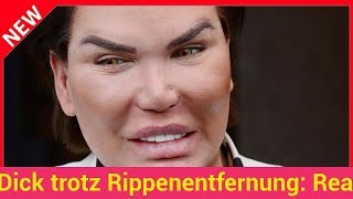 Dick trotz Rippenentfernung RealLifeKen will noch eine OP [upl. by Alfi]