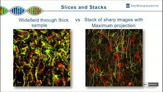 James Hayden  2Photon Microscopy How Deep Can You Go Part 1 [upl. by Ki335]