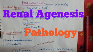 Renal Agenesis Pathology [upl. by Alyakcm]