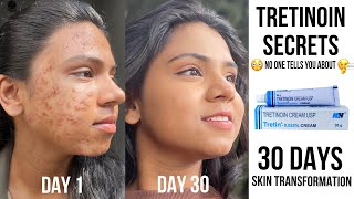 Tretinoin Secrets No one tells you about🤫🌸✨ My 30 days skin transformation using tretinoin [upl. by Aihsela]