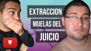 MUELAS DEL JUICIO CUIDADOS DESPUÉS DE LA EXTRACCIÓN 26 MI EXPERIENCIA [upl. by Notloc]