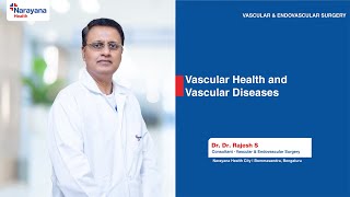 Vascular Health Diagnosis Treatment amp Prevention Tips [upl. by Combe]