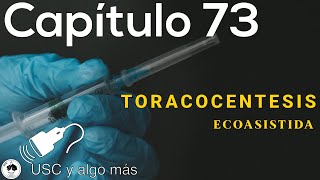 Capítulo 73 Toracocentesis Ecoasistida [upl. by Barnie]