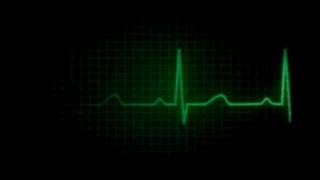 ekg flatline [upl. by Sarazen]