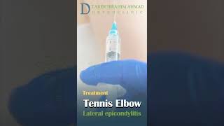 how to treat tennis elbow   lateral epicondylitis [upl. by Doralin]