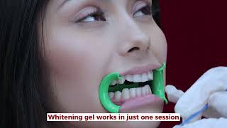 How do we do our teeth whitening [upl. by Dronski]