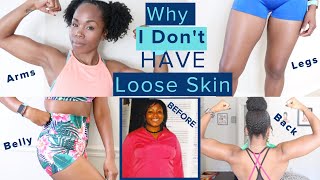 Why I Dont Have LOOSE SKIN After 100 Pound Weight Loss WITHOUT Surgery  TMI Skincare amp Nutrition [upl. by Anderer]