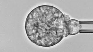 Human neutrophil versus Coccidioides cause of Valley fever Chemotaxis adhesion and phagocytosis [upl. by Norga]