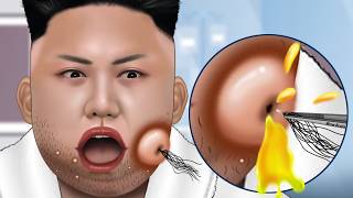 ASMR Facial care for Kim JongUn  Skincare Animation  Removal Ingrown Hair Sebum Shaving [upl. by Yve]