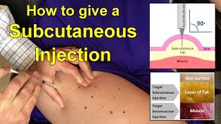 How to Give a Subcutaneous Injection Video [upl. by Airetas]