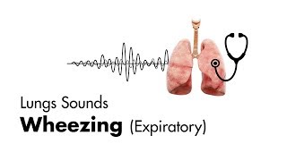 Wheezing expiratory  Lung Sounds  MEDZCOOL [upl. by Gemoets]