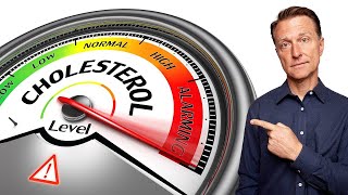 1 Top Remedy to Lower and Regulate Cholesterol [upl. by Morey]