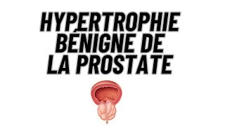 Hypertrophie bénigne de la prostate [upl. by Mahseh886]