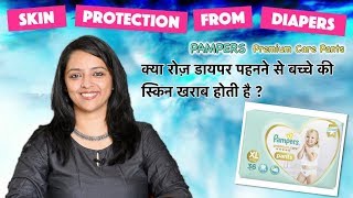 क्या रोज़ डायपर पहनने से बच्चे की स्किन खराब होती है  PROTECT BABY SKIN FROM DAILY DIAPER USE [upl. by Warrick]