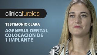 Clara  Agenesia dental [upl. by Mairim]