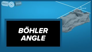 Böhler Angle│Daily Dose [upl. by Nieberg203]