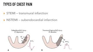 Chest Pain Rapid Review [upl. by Adnak]