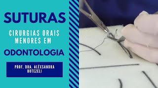 SUTURAS EM CIRURGIAS ORAIS MENORES EM ODONTOLOGIA [upl. by Hazlett]