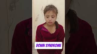 down syndrome tremor crouzon syndrome tinea Leishmaniasis [upl. by Refotsirk]