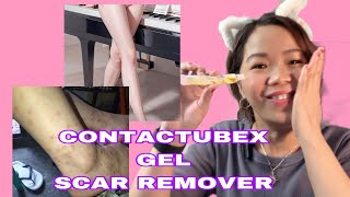 PAANO GAMITIN ANG CONTRACTUBEX GEL SCAR REMOVER UPDATE [upl. by Oler]