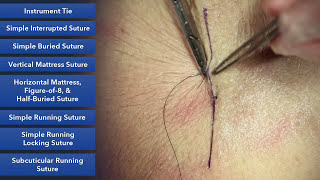 Learn How To Suture  Best Suture Techniques and Training [upl. by Htabmas]