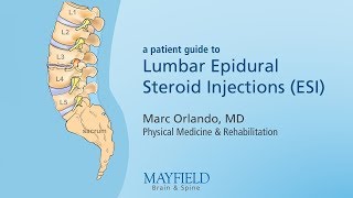 Lumbar Epidural Steroid Injections [upl. by Angelina]