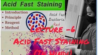 AFB Acid Fast Staining for MTuberculosis Bacillus staining medical viralvideoyoutube [upl. by Youngran]