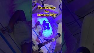 Phototherapy For Newborn  ytshorts shorts viralvideo trending phototherapy jaundice [upl. by Galen]