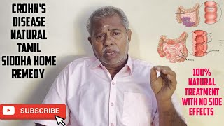 Crohns disease treatment in tamil  Best natural home remedy for crohns disease  Marunthu Venduma [upl. by Padraic]