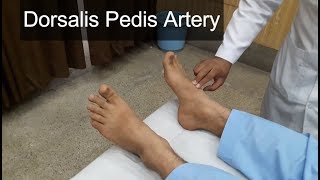 Dorsalis Pedis Artery Clinical Examination [upl. by Laurent]