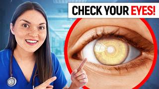 What Your EYES Say About your HEALTH Doctor Explains [upl. by Odnalro613]