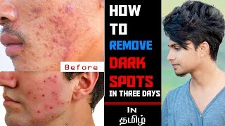 Remove DARK SPOTSBlack Spots In 3 Days IN TAMILSkin Care Tips For Men [upl. by Ardnoek815]