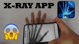 XRay App [upl. by Cherie232]