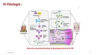 La polyarthrite rhumatoide [upl. by Bander152]