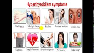 Pathology  dr Nafea  Thyroid Disease  Hyper amp Hypothyroidism  الغدة الدرقية [upl. by Ursola]