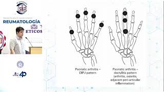 Presentación de casos Clínicos Reumatología [upl. by Essinger]