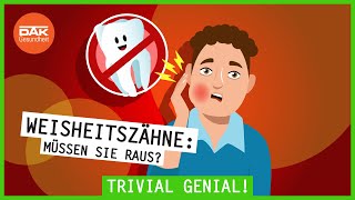 Weisheitszähne Müssen sie raus  trivialgenial  DAKGesundheit [upl. by Nemraciram]