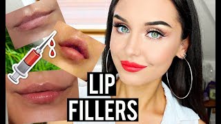 MY LIP FILLERS EXPERIENCE 💉 BEFORE AND AFTER JUVEDERM VOLIFT LIPS  KatesBeautyStation [upl. by Nosde81]