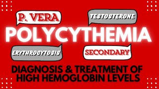 Polycythemia Diagnosis amp Treatment of Elevated Hemoglobin Level [upl. by Ahsiekram419]